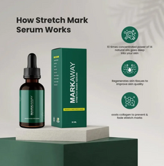 Markaway Stretch Mark Serum – Herbal Skin Repair (30ml)