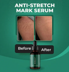 Anti-stretch mark serum bottle with 'Before' and 'After' comparison on a green background